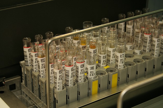 Proteina di Bence Jones - Laboratorio Dr. D'Errico Angelo