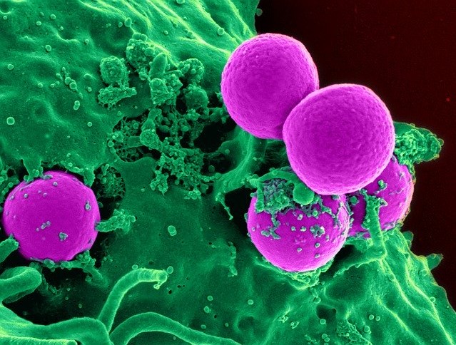 Neutropenia – neutrofili bassi - Laboratorio Dr. D'Errico Angelo